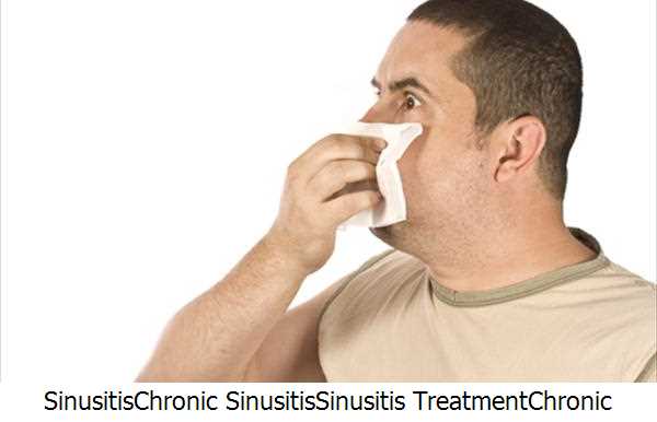 Sinusitis,Chronic Sinusitis,Sinusitis Treatment,Chronic Sinusitis Treatment,Symptoms Sinusitis,Sinusitis Headaches,Nasal Sinus,Headaches,Nasal Congestion,Sinus Trouble