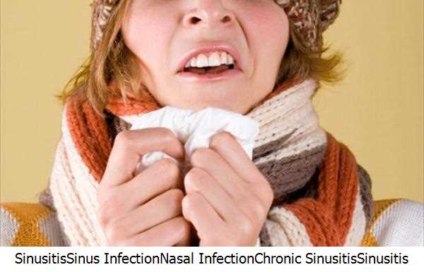 Sinusitis,Sinus Infection,Nasal Infection,Chronic Sinusitis,Sinusitis Symptoms,Sinus Infection Symptoms,Sinus Infection Treatments,Nasal Drip,Nasal Sinus,Infection Symptoms