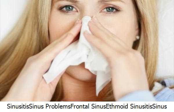 Sinusitis,Sinus Problems,Frontal Sinus,Ethmoid Sinusitis,Sinus Infection,Nasal Sinus,Nasal Irrigation